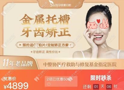 不定期搞優(yōu)惠——星雅口腔矯正活動(dòng)價(jià)
