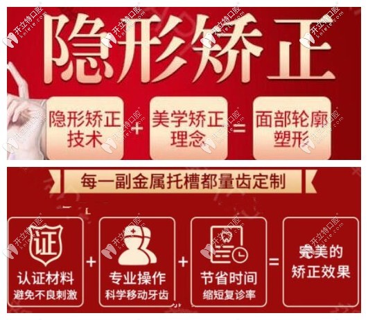 金屬托槽矯正及全隱形矯正的優(yōu)勢