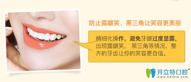 防止牙齒矯正過程中的露齦笑、黑三角