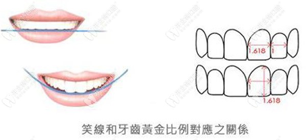 笑線和牙齒的黃金比例對應(yīng)之關(guān)系