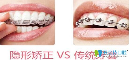 福州維樂中澤口腔隱形美顏矯正優(yōu)勢