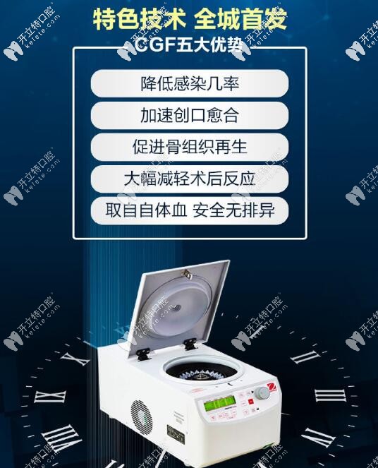 九龍口腔CGF特色項目種植優(yōu)勢