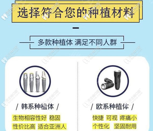 ?？诙c(diǎn)口腔韓系和歐系種植體