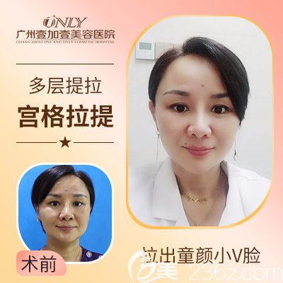 廣州壹加壹宮格提拉案例對(duì)比圖
