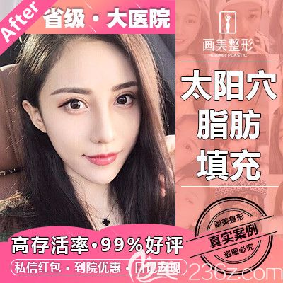 廣東畫美牟北平做的脂肪填充案例