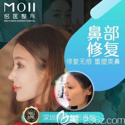 深圳銘醫(yī)張青松隆鼻修復(fù)案例