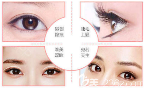 深圳華僑醫(yī)院整形科雙眼皮手術(shù)特點(diǎn)