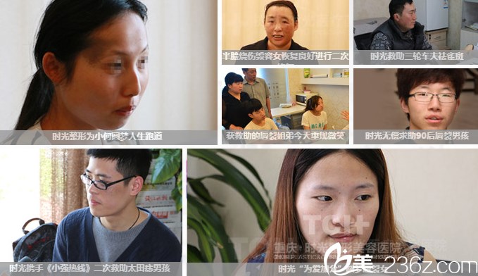 重慶時(shí)光整形美容醫(yī)院始終秉承社會(huì)責(zé)任，積極投身公益事業(yè)，與重慶衛(wèi)視天天630攜手，開啟“微笑行動(dòng)”大型公益活動(dòng)