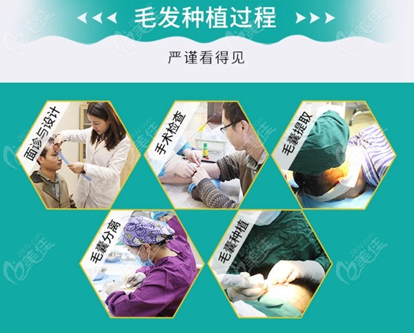 毛發(fā)移植手術(shù)過程圖