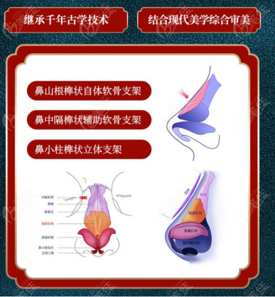 青島諾德醫(yī)學美容醫(yī)院隆鼻優(yōu)勢