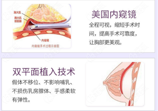 青島諾德醫(yī)學美容醫(yī)院假體隆胸優(yōu)勢