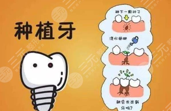 2025種植牙收費(fèi)價目表