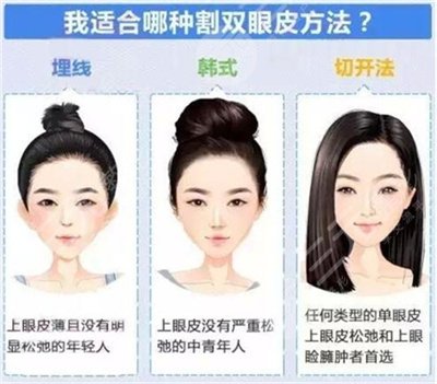 2025雙眼皮價格表一覽，雙眼皮手術分類及注意事項~